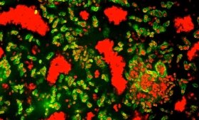 An image of bacterial colonies lit up with red and green light.