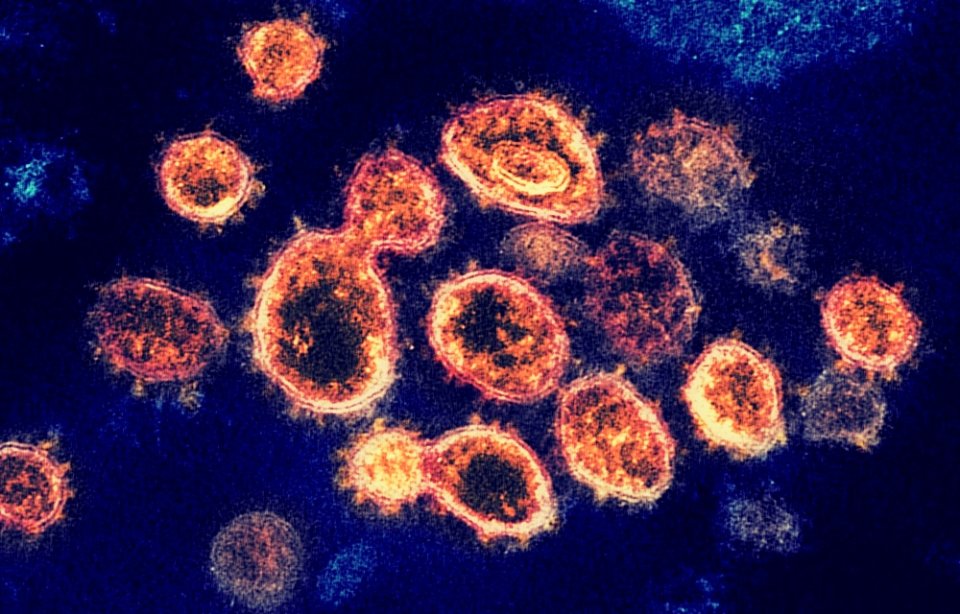 SARS-CoV-2 as seen under a transmission microscope.