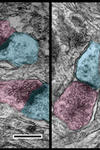 Two microscopic pictures, side by side. In both of them, some structures have been colored in blue and some in pink. 